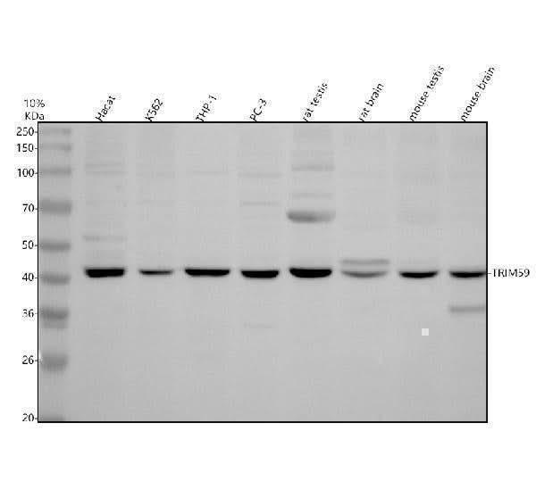 Anti-TRIM59 Antibody Picoband® Boster Bio