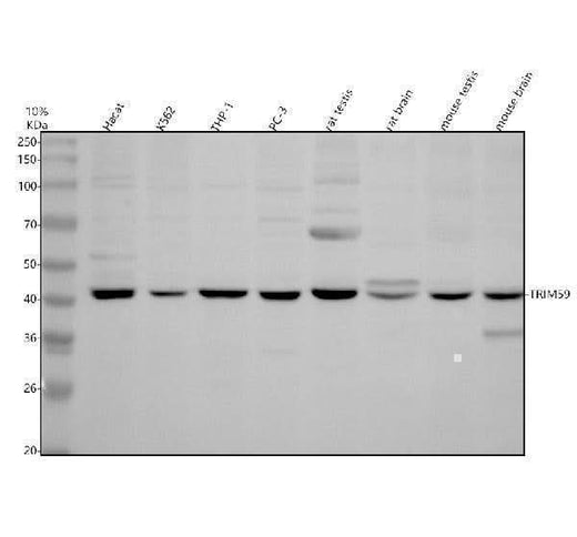 Anti-TRIM59 Antibody Picoband® Boster Bio