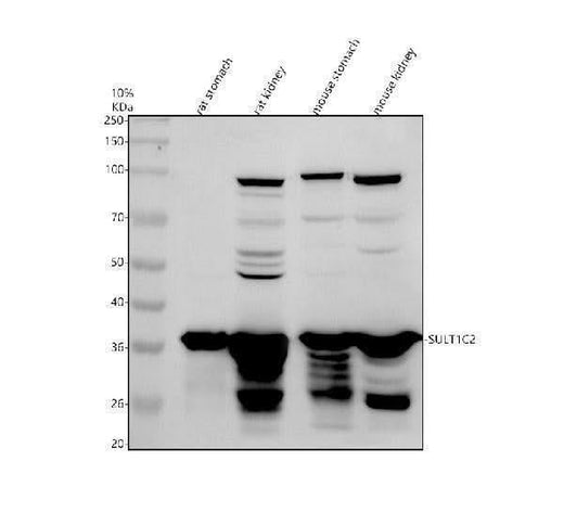 Anti-SULT1C2 Antibody Picoband® Boster Bio
