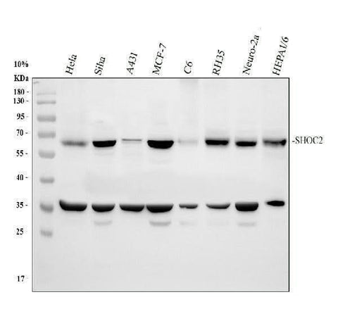 Anti-Shoc2/Sur8 Antibody Picoband® Boster Bio