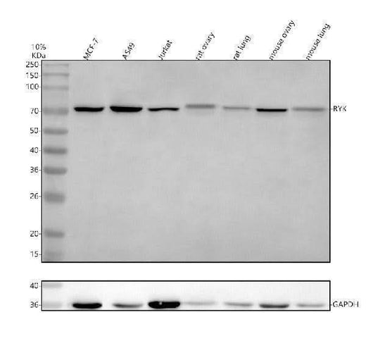 Anti-RYK Antibody Picoband® Boster Bio