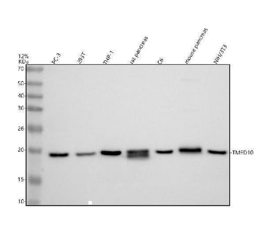Anti-TMP21/TMED10 Antibody Picoband® Boster Bio