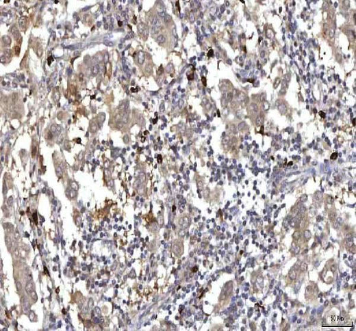 Anti-RASGRP3 Antibody Boster Bio