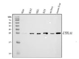 Anti-LYPLA1 Antibody Picoband® Boster Bio