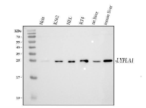 Anti-LYPLA1 Antibody Picoband® Boster Bio