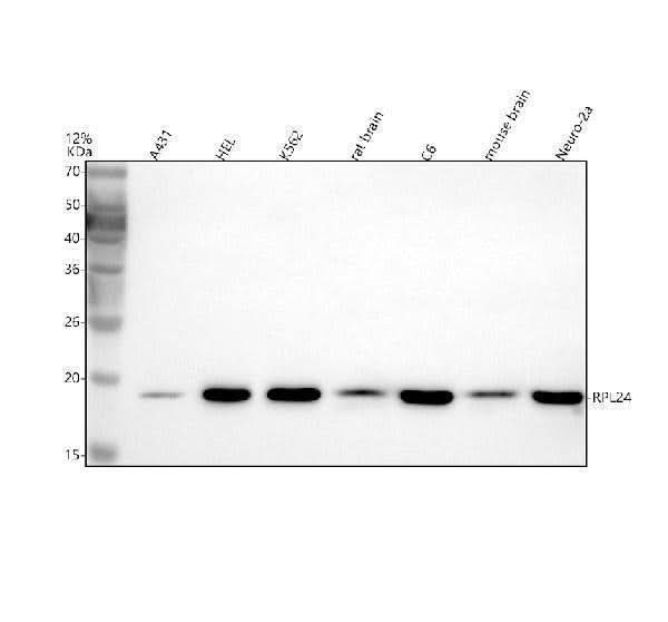 Anti-RPL24 Antibody Picoband® Boster Bio