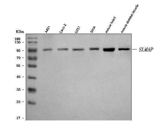Anti-SLMAP Antibody Picoband® Boster Bio