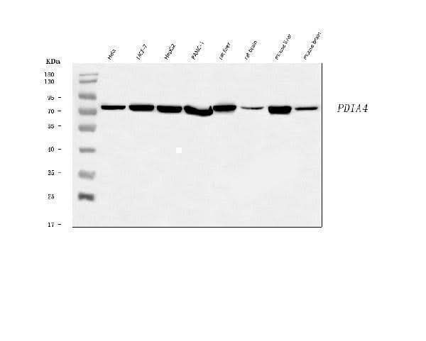 Anti-ERp72/PDIA4 Antibody Picoband® Boster Bio