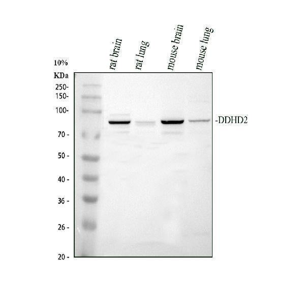 Anti-DDHD2 Antibody Picoband® Boster Bio