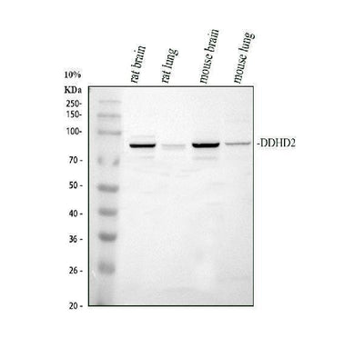Anti-DDHD2 Antibody Picoband® Boster Bio