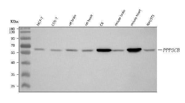 Anti-PPP3CB Antibody Picoband® Boster Bio