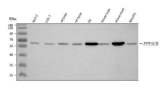 Anti-PPP3CB Antibody Picoband® Boster Bio