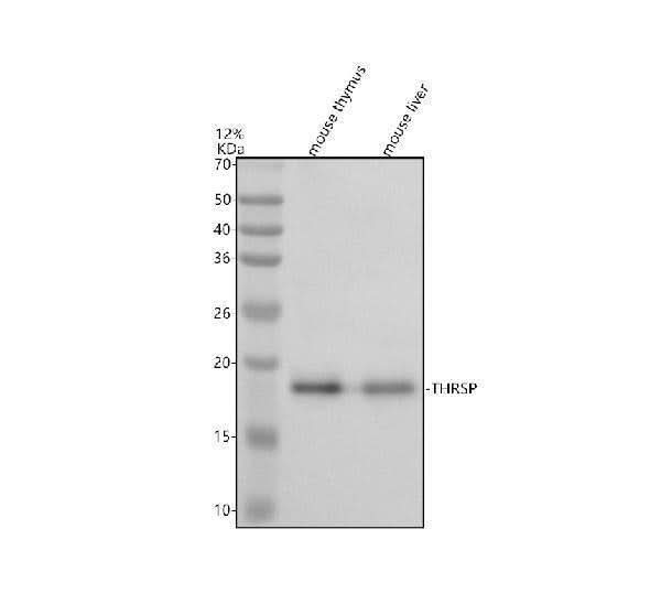 Anti-THRSP Antibody Picoband® Boster Bio