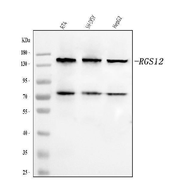 Anti-RGS12 Antibody Picoband® Boster Bio