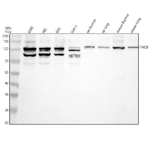 Anti-TMC6 Antibody Picoband® Boster Bio