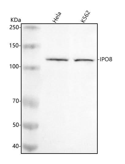 Anti-IPO8 Antibody Picoband® Boster Bio