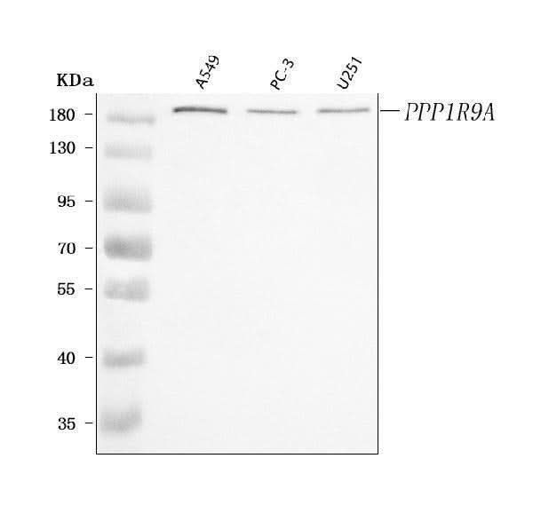 Anti-PPP1R9A Antibody Picoband® Boster Bio