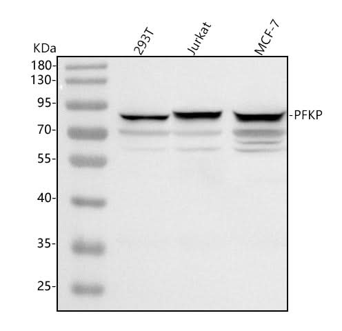 Anti-PFKP Antibody Picoband® Boster Bio
