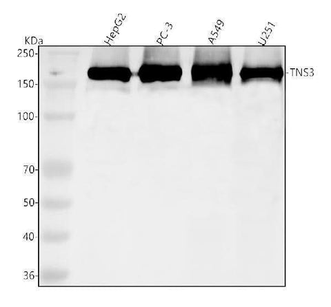 Anti-TNS3 Antibody Picoband® Boster Bio