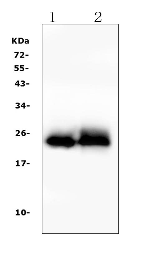 Anti-Troponin I fast skeletal muscle/TNNI2 Antibody Picoband® Boster Bio