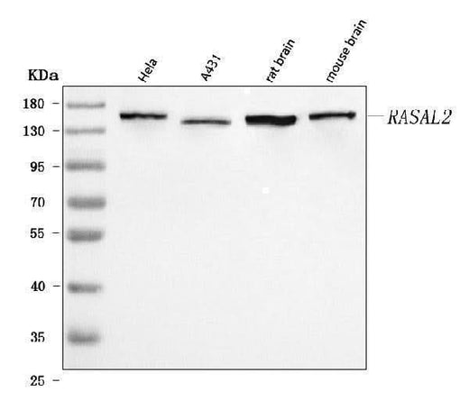 Anti-RASAL2 Antibody Picoband® Boster Bio