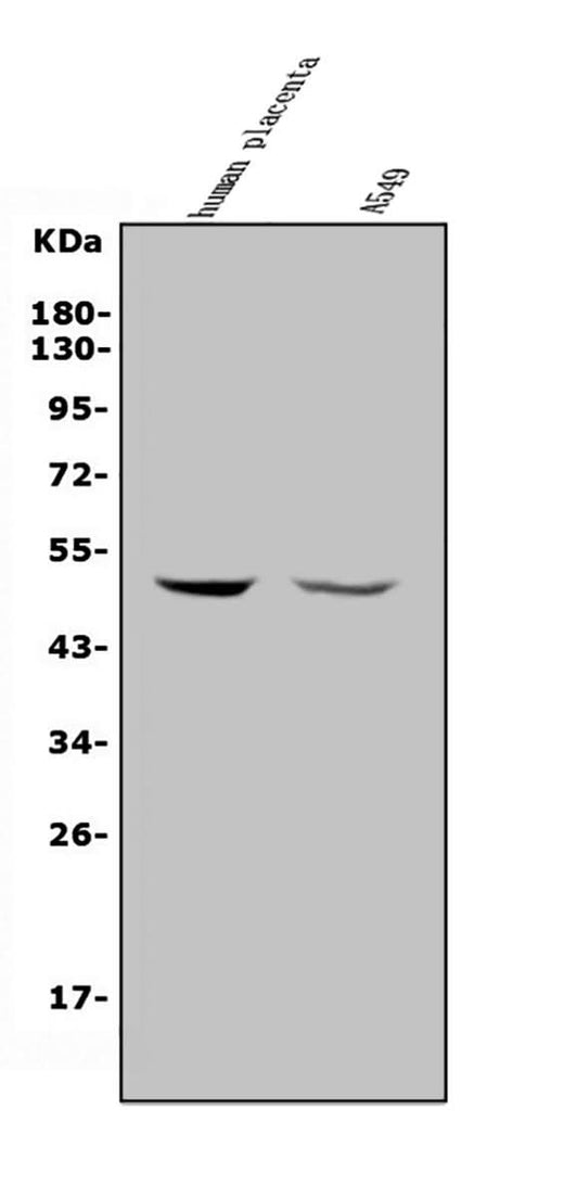 Anti-MMP28 Antibody Picoband® Boster Bio