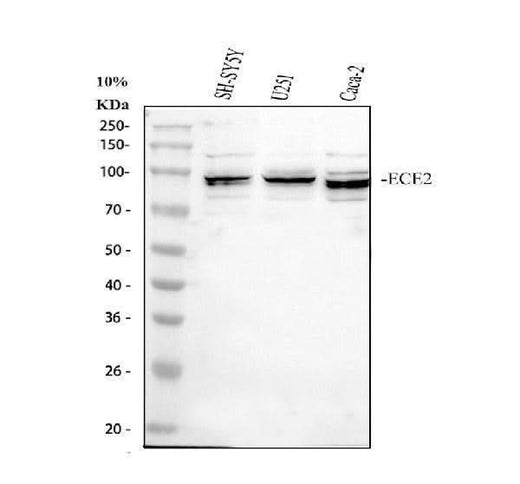 Anti-ECE2 Antibody Picoband® Boster Bio