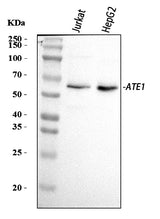 Anti-ATE1 Antibody Picoband® Boster Bio