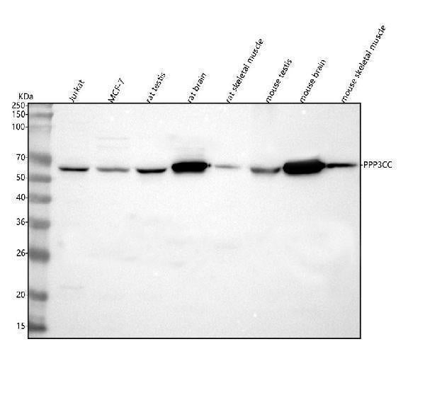 Anti-PPP3CC Antibody Picoband® Boster Bio