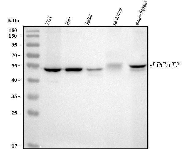 Anti-LPCAT2 Antibody Picoband® Boster Bio