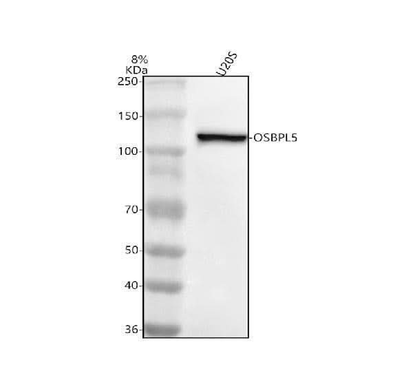 Anti-OSBPL5 Antibody Picoband® Boster Bio
