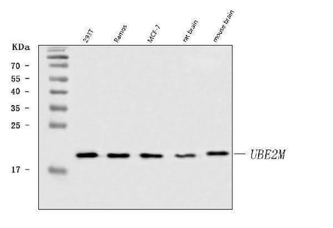 Anti-UBC12/UBE2M Antibody Picoband® Boster Bio