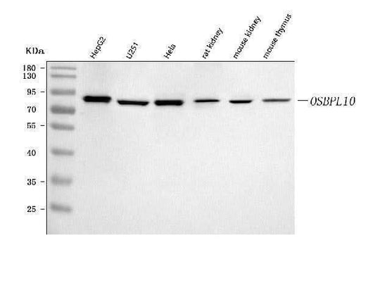 Anti-OSBPL10 Antibody Picoband® Boster Bio