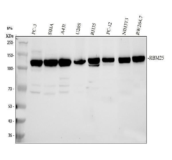 Anti-RBM25 Antibody Picoband® Boster Bio