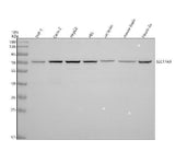 Anti-SLC17A9 Antibody Picoband® Boster Bio