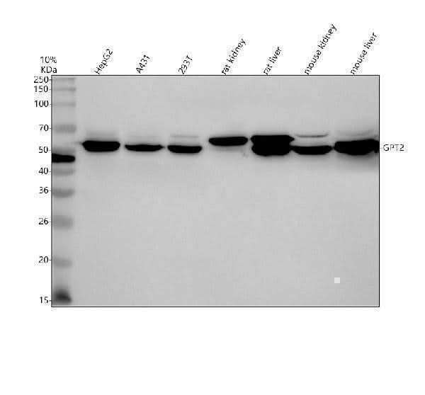 Anti-GPT2 Antibody Picoband® Boster Bio