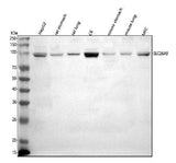Anti-SLC26A9 Antibody Picoband® Boster Bio