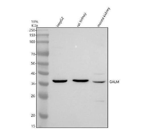 Anti-GALM Antibody Picoband® Boster Bio