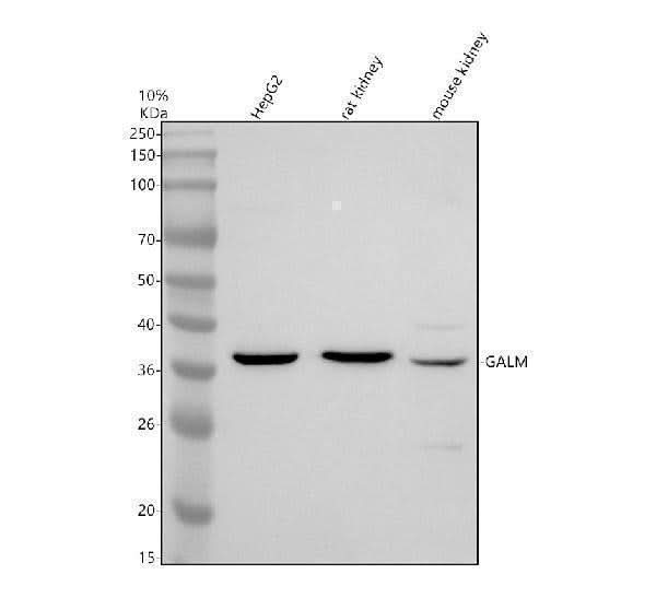 Anti-GALM Antibody Picoband® Boster Bio