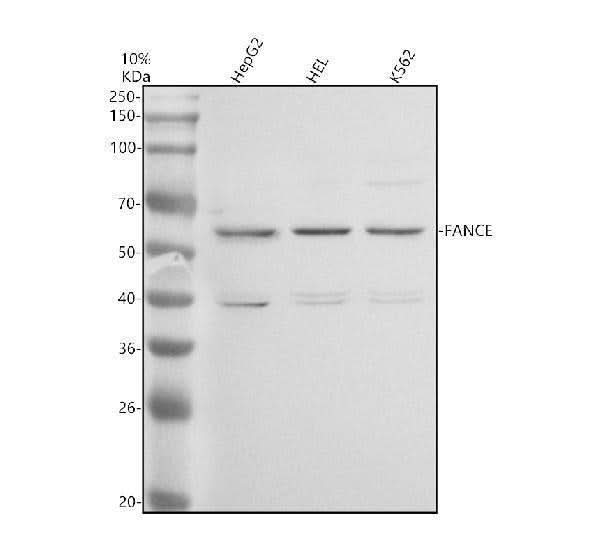 Anti-FANCE Antibody Picoband® Boster Bio