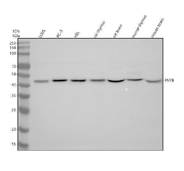 Anti-FNTB Antibody Picoband® Boster Bio