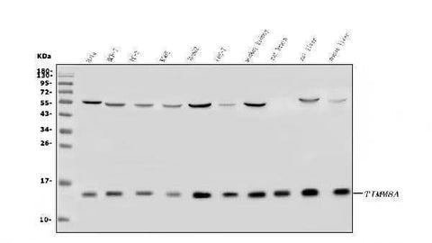 Anti-TIMM8A/DDP Antibody Picoband® Boster Bio