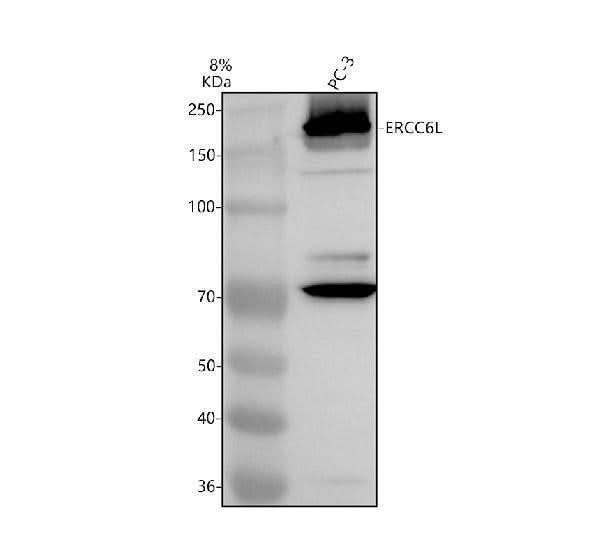 Anti-ERCC6L Antibody Picoband® Boster Bio