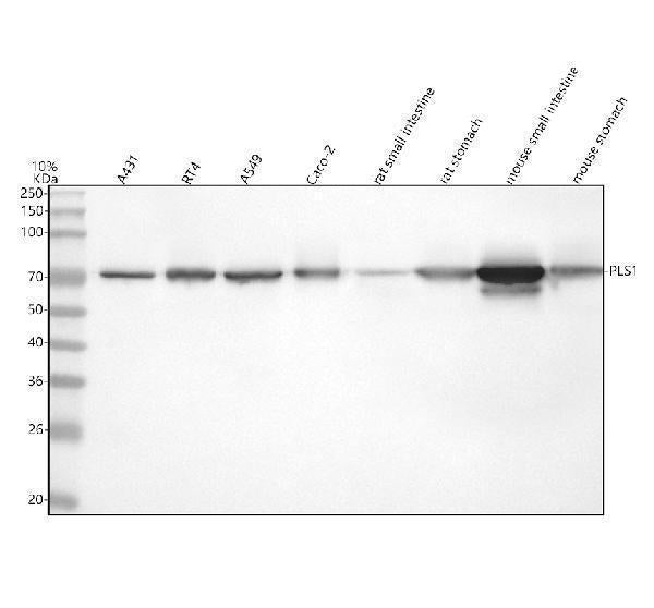 Anti-PLS1 Antibody Picoband® Boster Bio