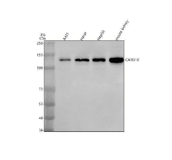 Anti-CARD10 Antibody Picoband® Boster Bio