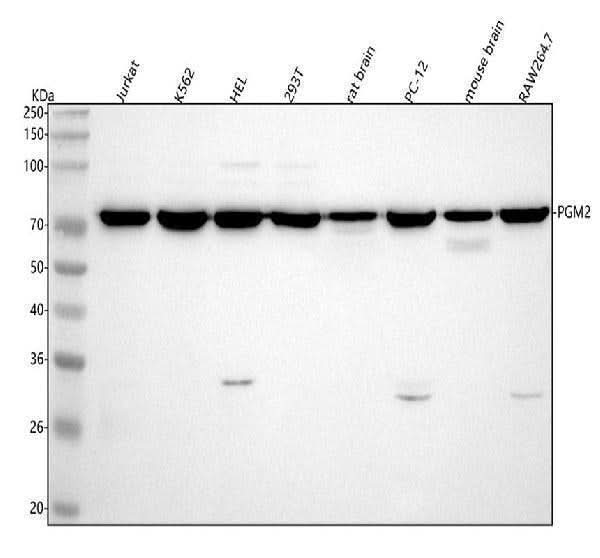 Anti-PGM2 Antibody Picoband® Boster Bio