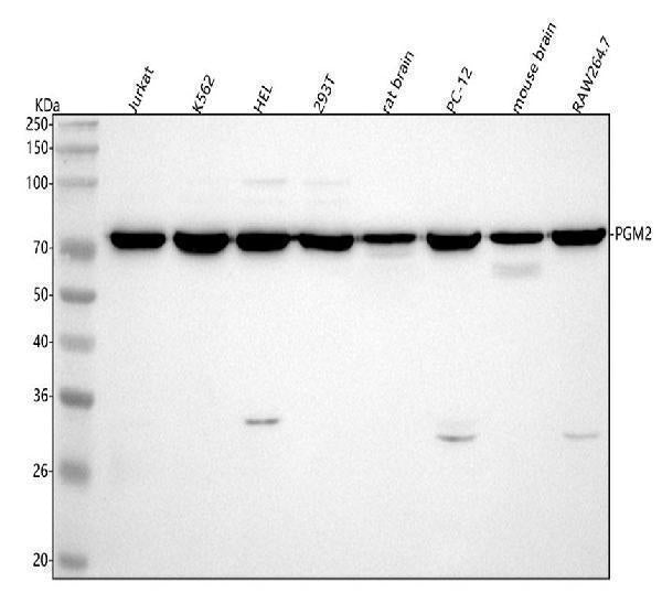 Anti-PGM2 Antibody Picoband® Boster Bio