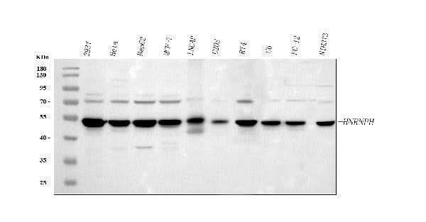 Anti-HnRNP H/HNRNPH1 Antibody Picoband® Boster Bio