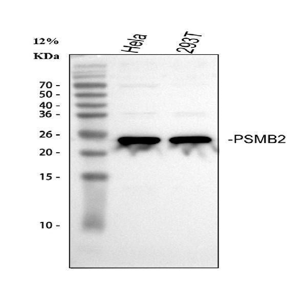 Anti-PSMB2 Antibody Picoband® Boster Bio