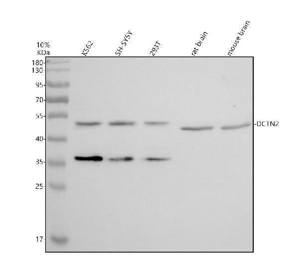 Anti-Dynamitin 2/DCTN2 Antibody Picoband® Boster Bio